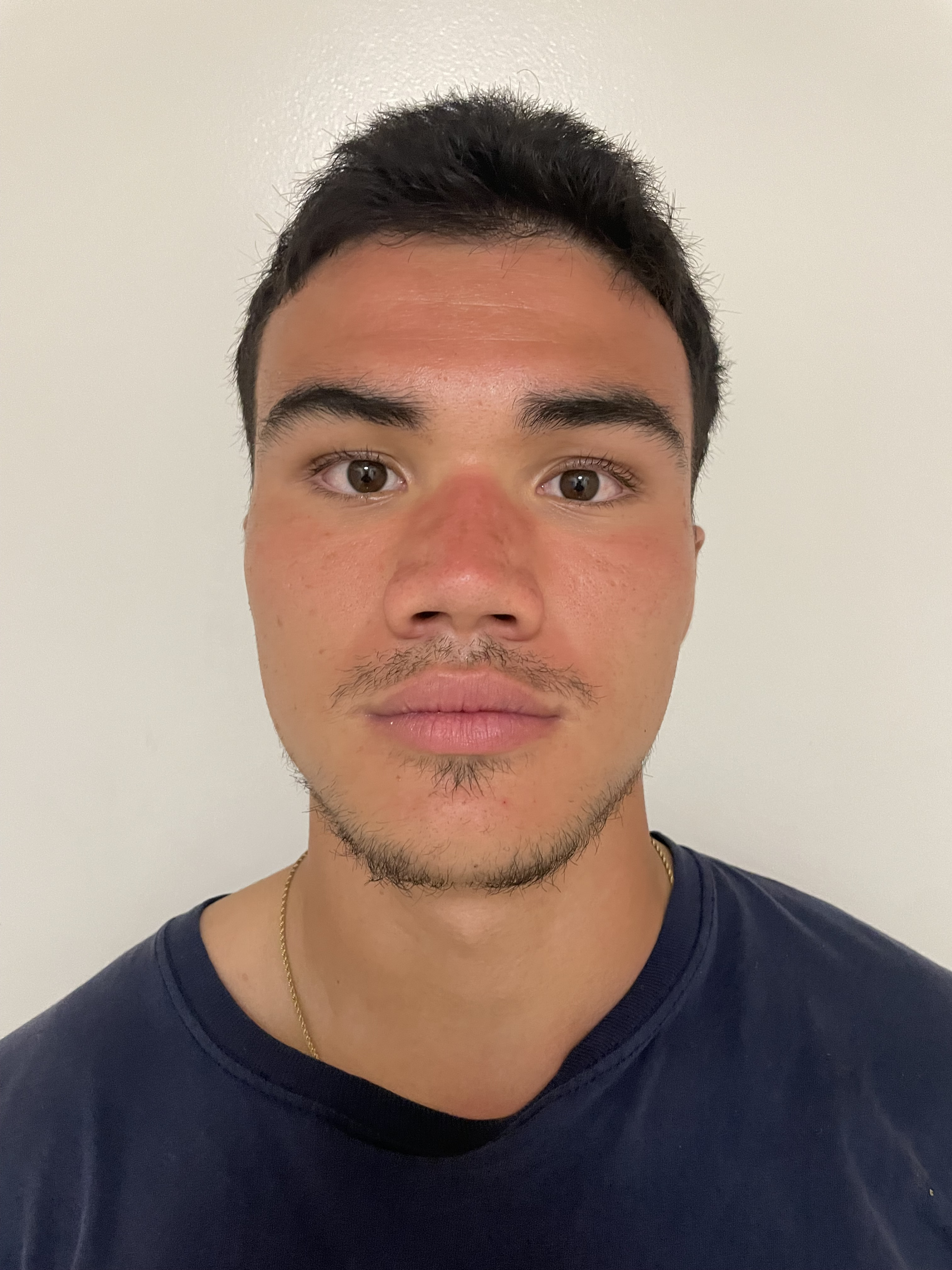 Photo of Cheesy Bacon Chicken Broccoli Casserole